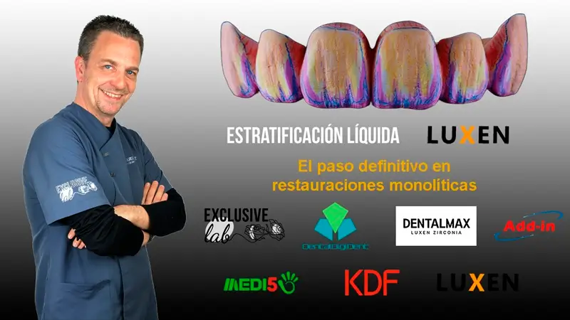 Webinar YouTube Realizado el 10 de Octubre de 2025 por DentalDigiDent Webinar YouTube Realizado el 10 de Octubre de 2025 por DentalDigiDent, representado por JuanJosé Arenaz Otero