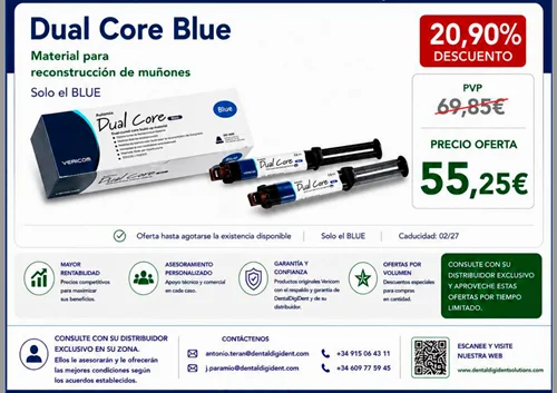 Dual core blue material para reconstrucción de muñones en dentaldigidentsolutions